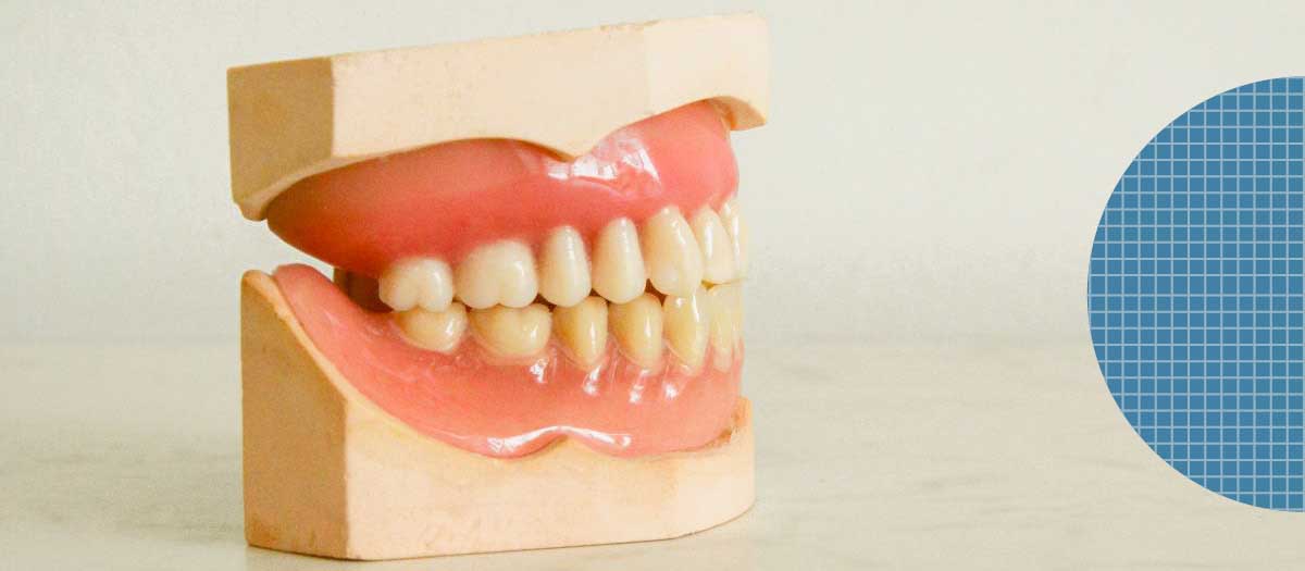 Set of false teeth