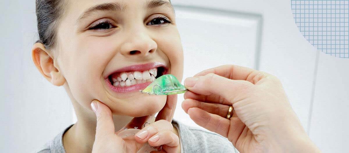 girl placing retainer in her mouth